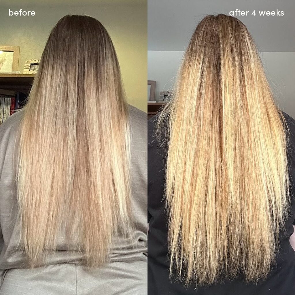 Hair FALL