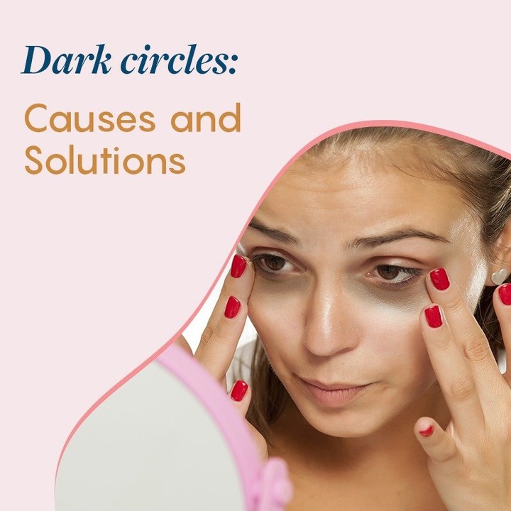 Dark Circles Remedy