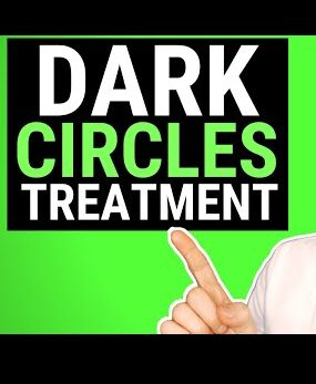 dark circles
