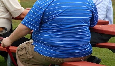 Obesity